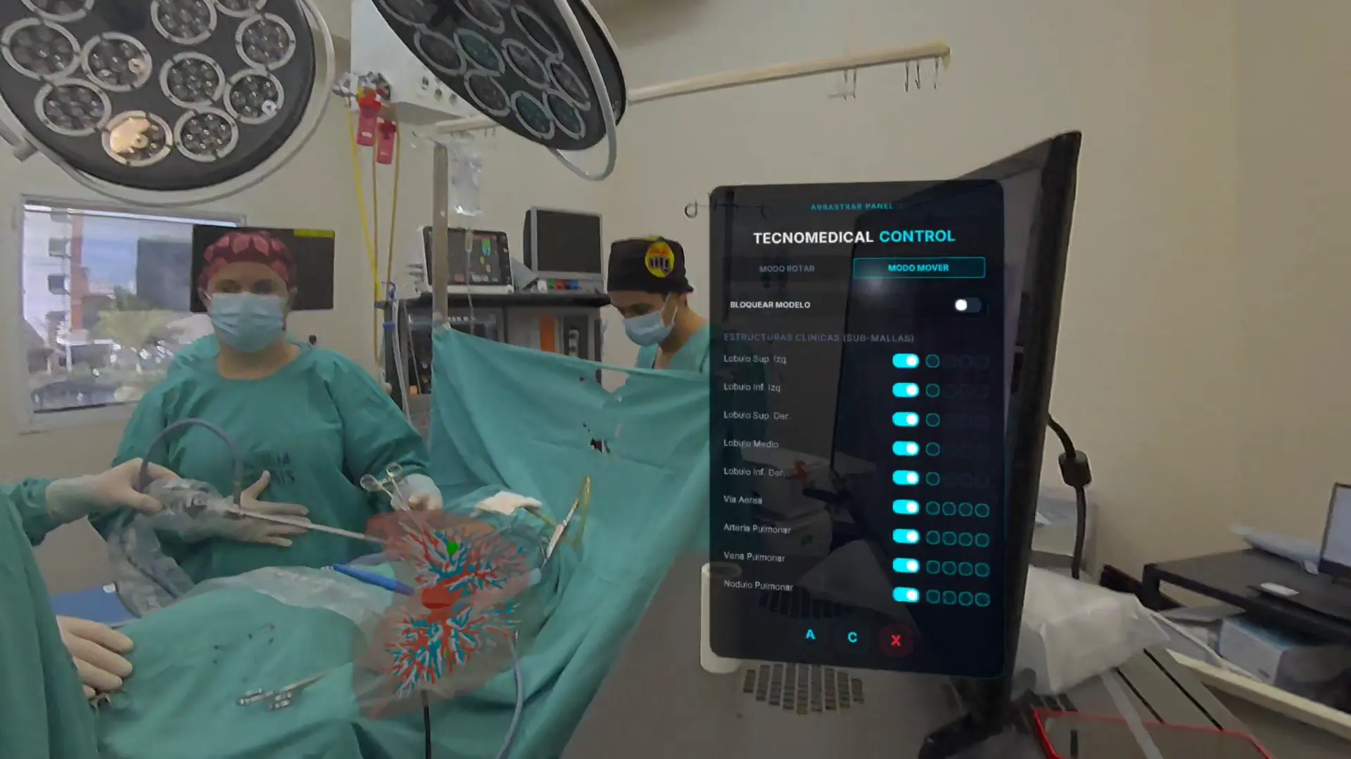 Modelo pulmonar tridimensional visible mediante realidad aumentada en el quirófano